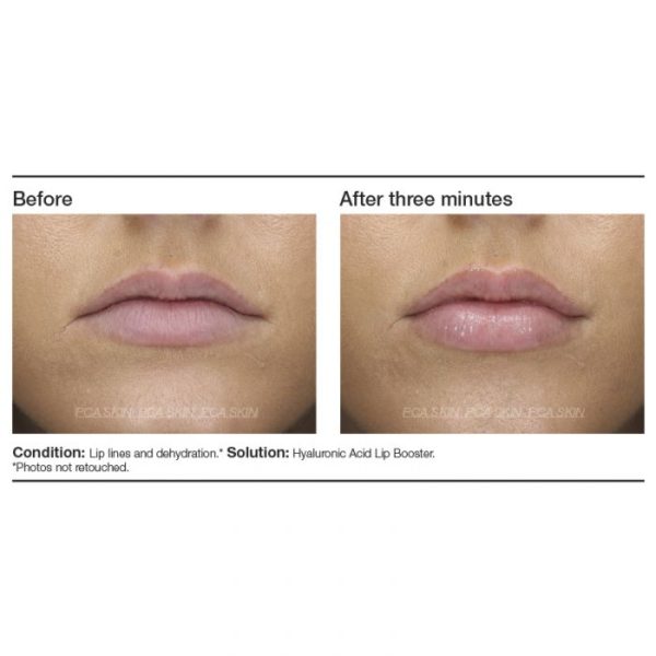 Hyaluronic Acid Lip Booster