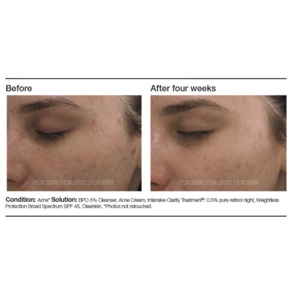 Intensive Clarity Treatment®: 0.5% pure retinol night